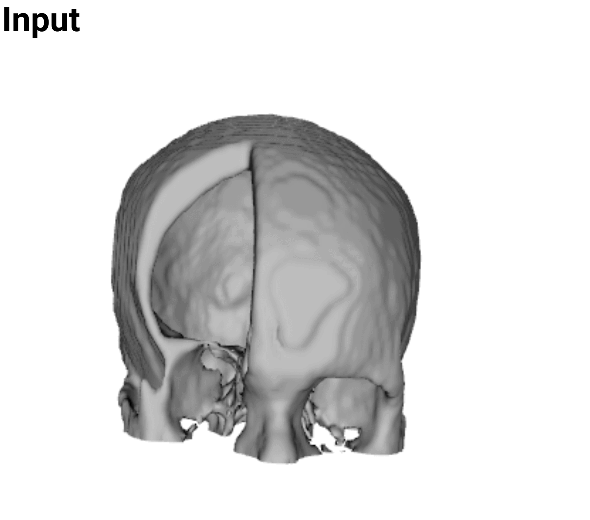 Facial defect reconstruction example