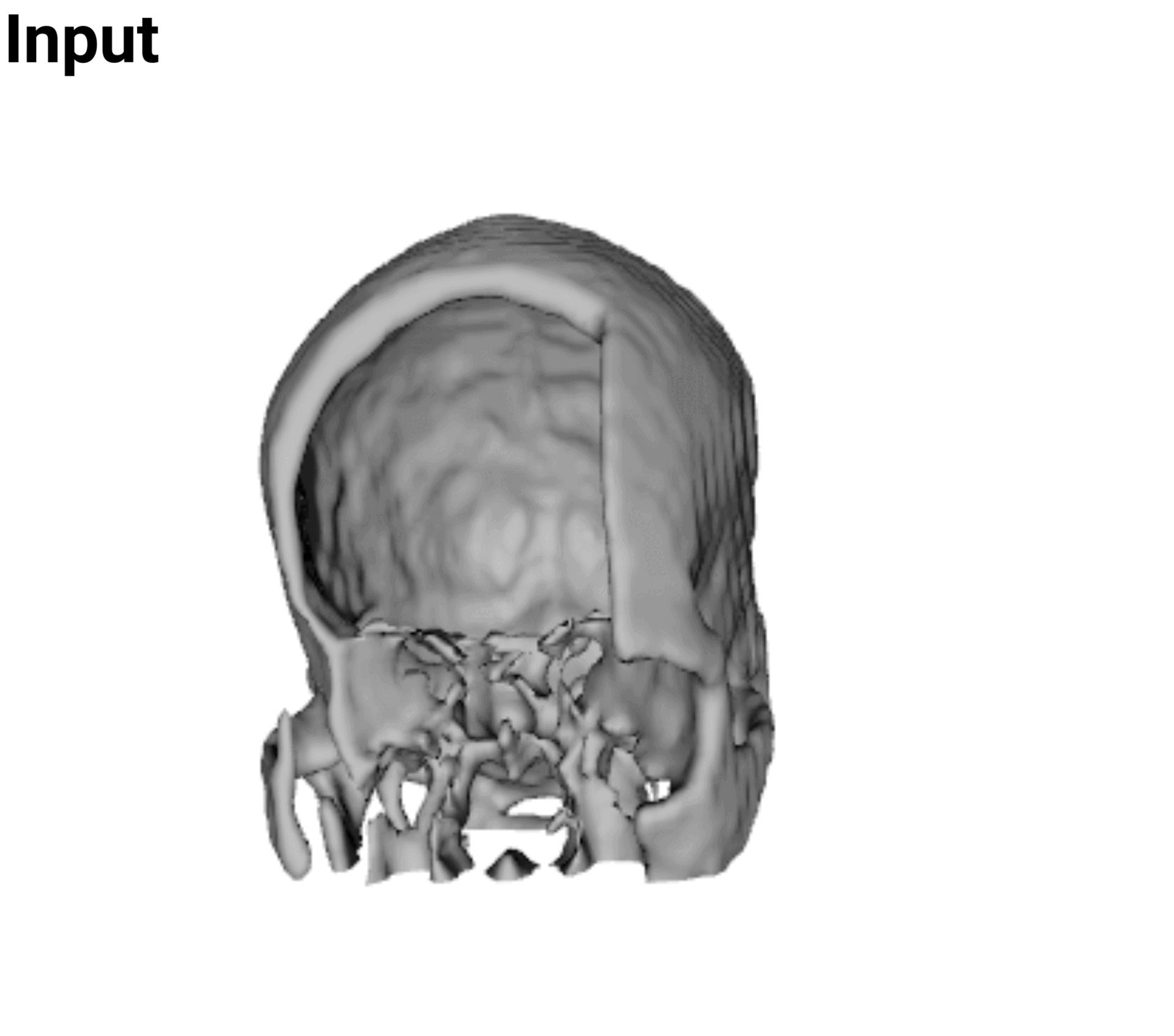 Facial defect reconstruction example